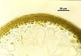 Sezione trasversale della fronda a livello di un soro di organi pluriloculari